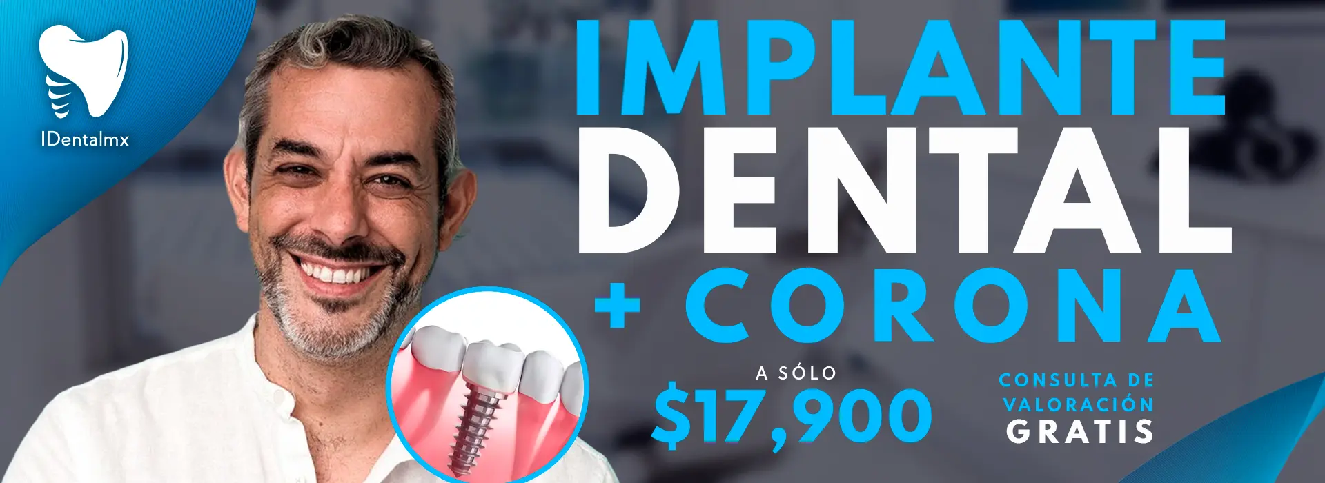 Promoción pago inicial implante dental
